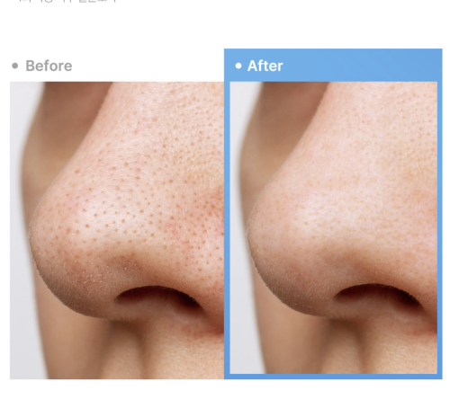 Medicube      , Zero Pore Blackhead Deep Cleansing Oil  4