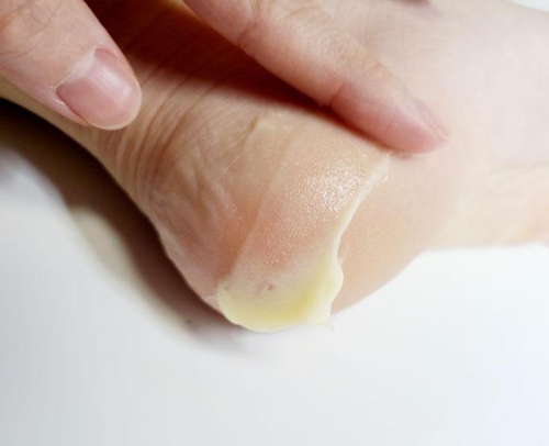 MEDIPEEL ����������������� ������-���� ��� ��� � ���������, EGF Scaling Moisture Foot Cream ���� 4
