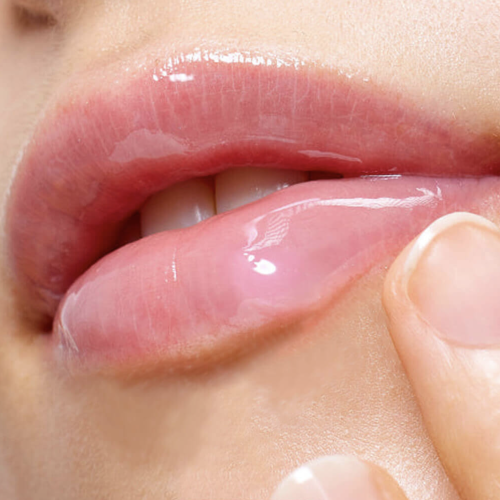 Arencia ������������ �����-������� ��� ��� � ���� � ����������, Honey Glazed Collagen Lip Mask ���� 3